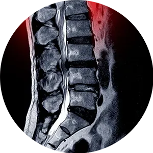 Chiropractor For Spinal Issues in Adults Near Me in Missouri City, TX.